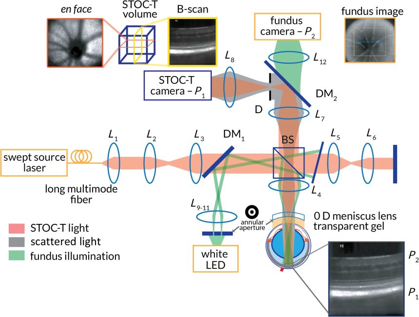 Using advanced optical tomography to assess ocular microcirculation