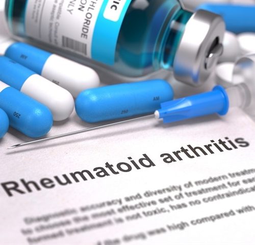 shutterstock_390538711_6b3c40fdd32742caa54307db3553cab1-620x480.jpg Immune molecule found to play a key role in regulating inflammation in rheumatoid arthritis